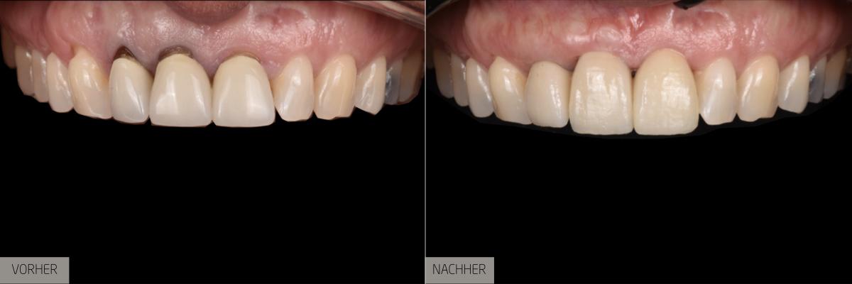 Zahnbehandlung – Vom Problem zum strahlenden Lächeln