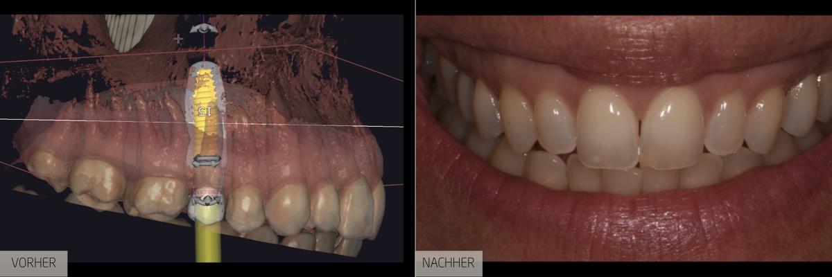 Zahnbehandlung – Vom Problem zum strahlenden Lächeln